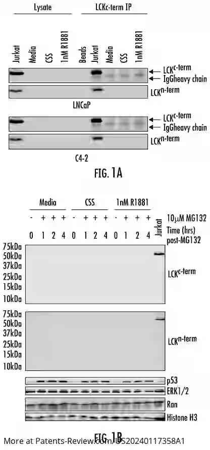 Drawing 02 for METHODS AND COMPOSITIONS FOR DIAGNOSING AND TREATING PROSTATE CANCER BASED ON LONG NONCODING RNA OVERLAPPING THE LCK GENE THAT REGULATES PROSTATE CANCER CELL GROWTH