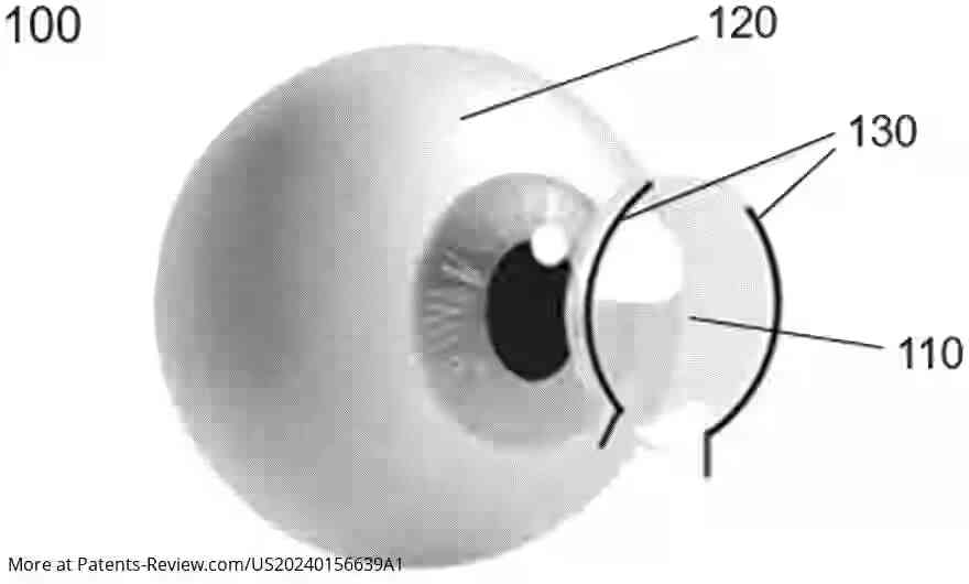 Drawing 01 for CONTACT LENSES WITH INTEGRATED ELECTRONICS AND METHOD OF MAKING THE SAME