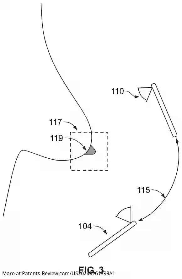 Drawing 04 for SYSTEMS AND METHODS FOR BABY BOTTLE MANUFACTURING