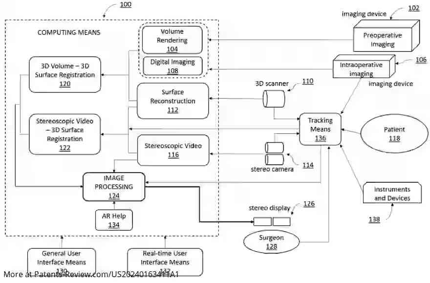 Drawing 01 for Augmented reality guidance for spinal surgery with stereoscopic displays and magnified views