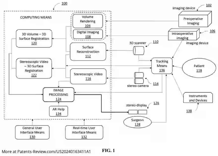 Drawing 02 for Augmented reality guidance for spinal surgery with stereoscopic displays and magnified views