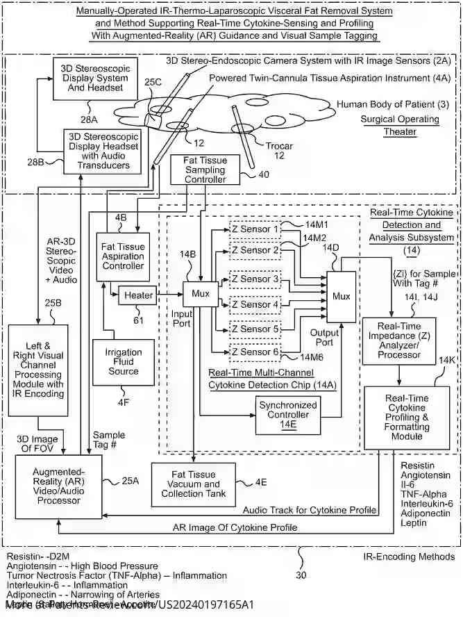 Drawing 01 for METHOD OF AND SYSTEM FOR OBESITY TREATMENT USING LAPAROSCOPICALLY-GUIDED 3D-STEREOSCOPIC AND IR-THERMOGRAPHIC INTRA-ABDOMINAL VISCERAL FAT ASPIRATION, SUPPORTED BY REAL-TIME CYTOKINE SENSING AND PROFILING AND AUGMENTED-REALITY (AR) DISPLAY AND VISUAL SAMPLE TAGGING