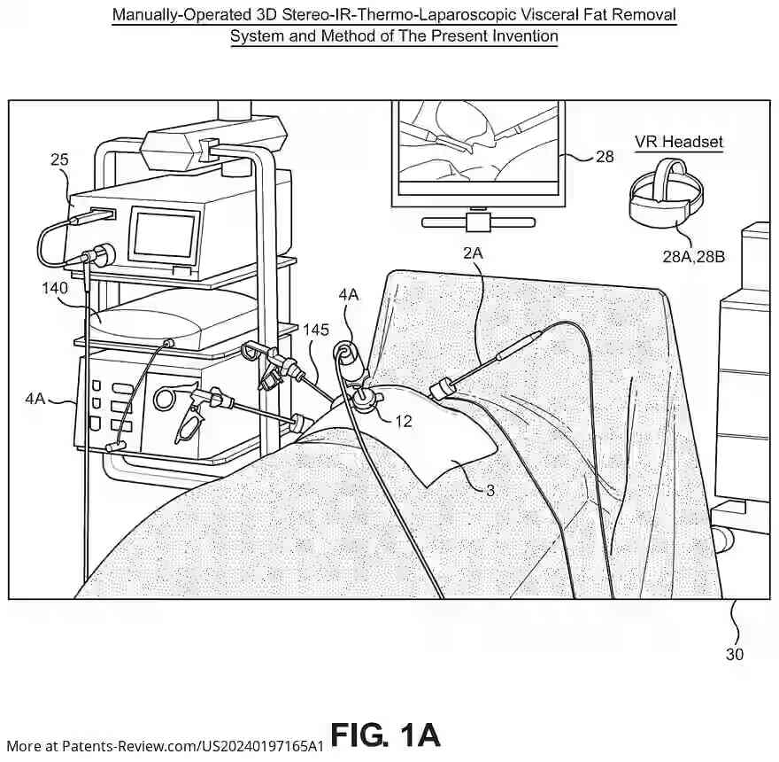 Drawing 02 for METHOD OF AND SYSTEM FOR OBESITY TREATMENT USING LAPAROSCOPICALLY-GUIDED 3D-STEREOSCOPIC AND IR-THERMOGRAPHIC INTRA-ABDOMINAL VISCERAL FAT ASPIRATION, SUPPORTED BY REAL-TIME CYTOKINE SENSING AND PROFILING AND AUGMENTED-REALITY (AR) DISPLAY AND VISUAL SAMPLE TAGGING