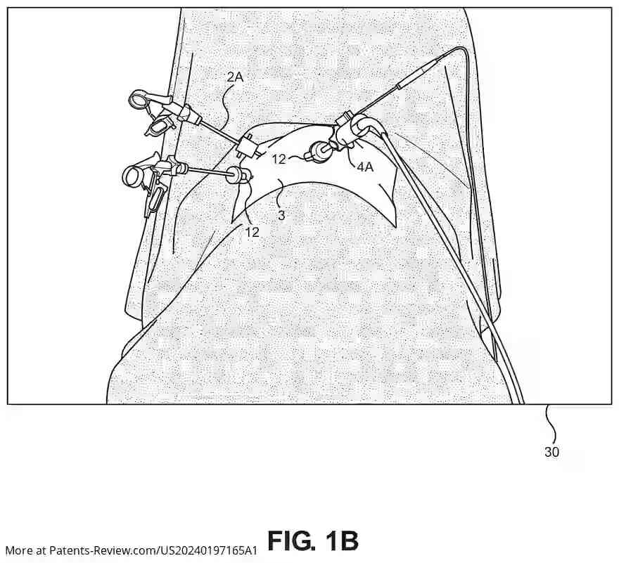 Drawing 03 for METHOD OF AND SYSTEM FOR OBESITY TREATMENT USING LAPAROSCOPICALLY-GUIDED 3D-STEREOSCOPIC AND IR-THERMOGRAPHIC INTRA-ABDOMINAL VISCERAL FAT ASPIRATION, SUPPORTED BY REAL-TIME CYTOKINE SENSING AND PROFILING AND AUGMENTED-REALITY (AR) DISPLAY AND VISUAL SAMPLE TAGGING