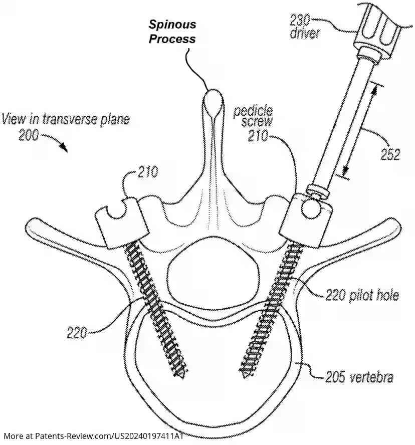 Drawing 01 for SYSTEM AND METHOD FOR LIDAR-BASED ANATOMICAL MAPPING