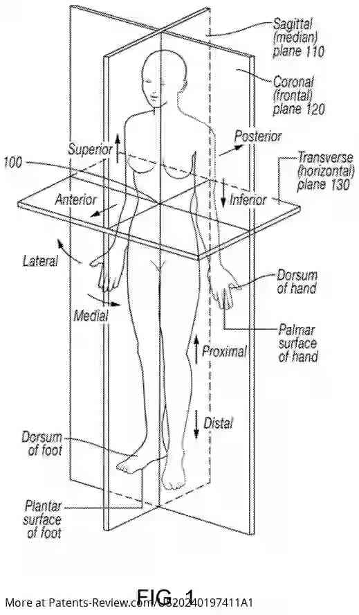 Drawing 02 for SYSTEM AND METHOD FOR LIDAR-BASED ANATOMICAL MAPPING