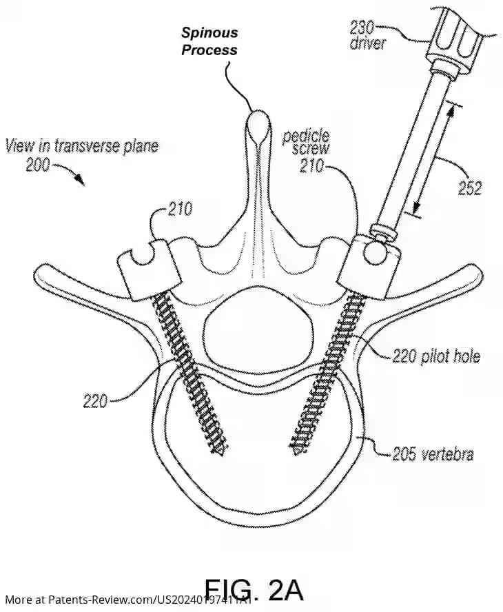 Drawing 03 for SYSTEM AND METHOD FOR LIDAR-BASED ANATOMICAL MAPPING