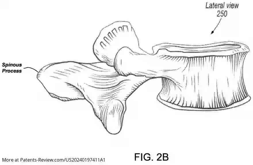 Drawing 04 for SYSTEM AND METHOD FOR LIDAR-BASED ANATOMICAL MAPPING