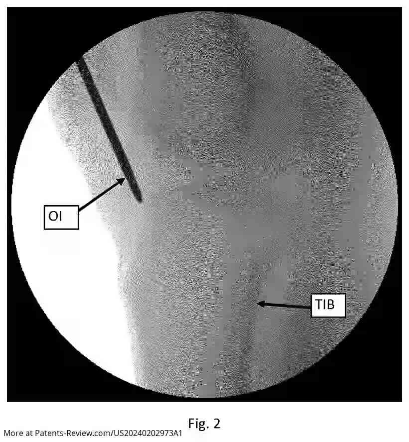 Drawing 03 for NEAR-REAL-TIME CONTINUAL 3D REGISTRATION OF OBJECTS IN 2D X-RAY IMAGES