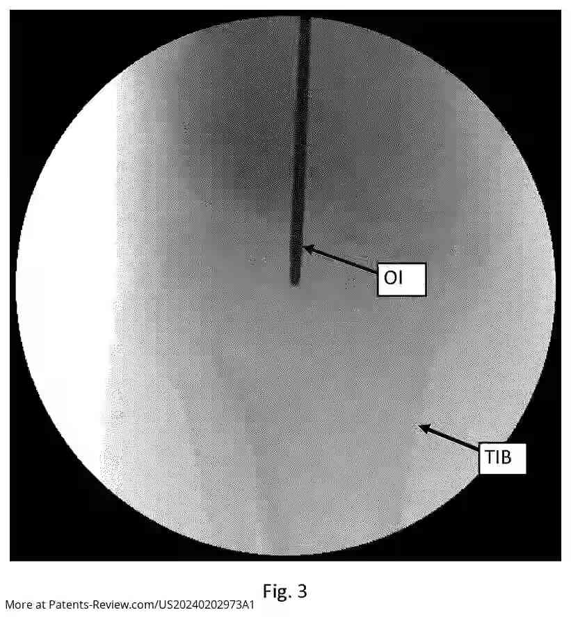 Drawing 04 for NEAR-REAL-TIME CONTINUAL 3D REGISTRATION OF OBJECTS IN 2D X-RAY IMAGES