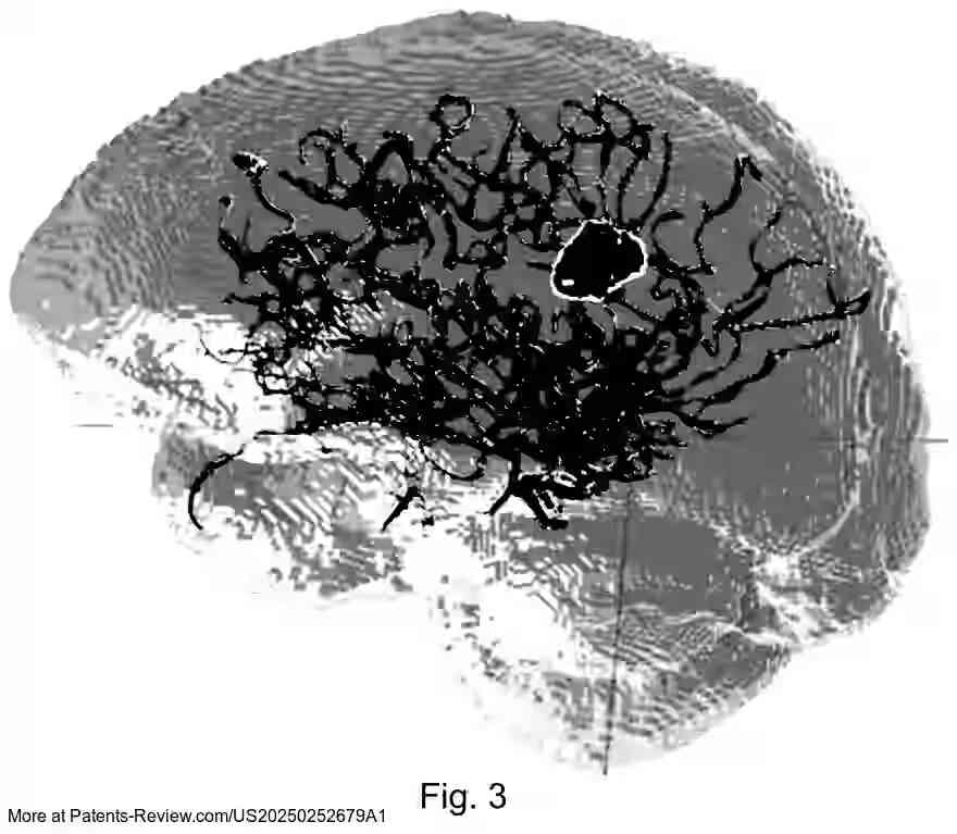 Drawing 04 for LIVE SURGICAL AID FOR BRAIN TUMOR RESECTION USING AUGMENTED REALITY AND DEEP LEARNING